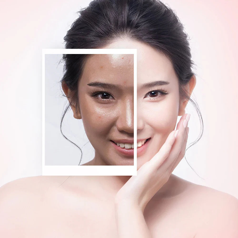 Skin Radiance