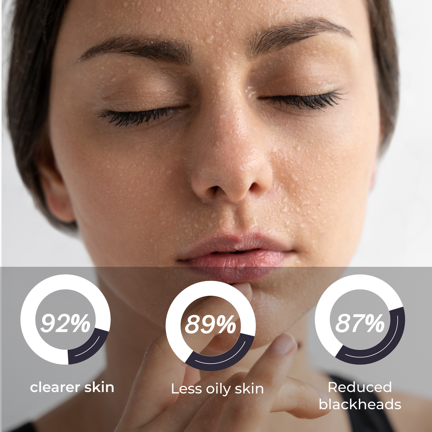 L’Offia ClearSkin 2% Salicylic Acid Acne Control Serum for Pimples & Oily Skin – 30ml