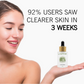 L’Offia ClearSkin 2% Salicylic Acid Acne Control Serum for Pimples & Oily Skin – 30ml
